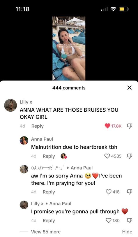 anna paul leaks|Anna Paul : r/AussieTikTokSnark